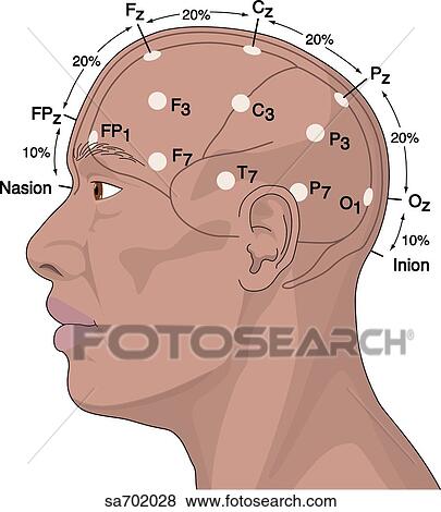 Stock Illustration - Lateral view of head of African American male showing proper EEG electrode placement.. Fotosearch