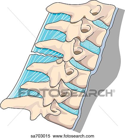 Lateral view of vertebral column showing injury caused by hyperflexion. View Large Illustration Stock Illustration - Lateral view of vertebral column showing injury caused by hyperflexion.. Fotosearch