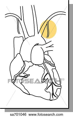 Orientation drawing shows location of mammary artery. View Large Illustration Stock Illustration - Orientation drawing shows location of mammary artery.. Fotosearch