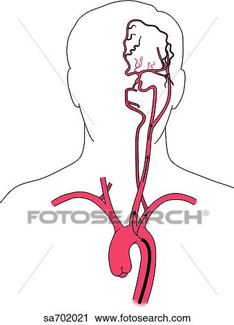 Clip Art - Orientation figure showing location and origination of pictured arteries.. Fotosearch