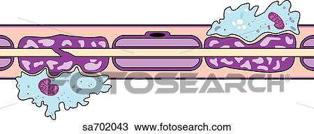 Drawing - Removal of myelin sheath of CNS in multiple sclerosis.. Fotosearch