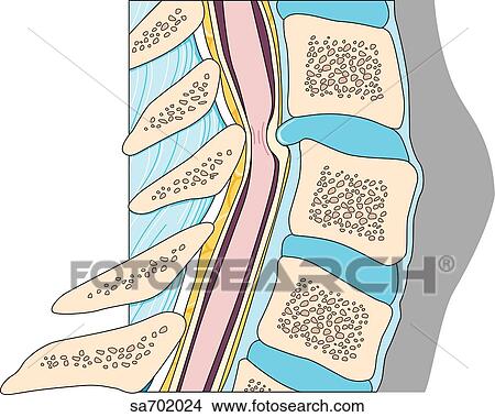 Stock Illustration - Sagittal view of section of vertebral column showing anterior dislocation of cervical spine.. Fotosearch