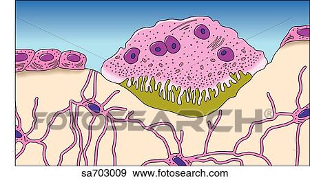 Schematic representation of the different types of bone cells in situ: osteoblast features prominently in foreground. View Large Illustration Stock Illustration - Schematic representation of the different types of bone cells in situ: osteoblast features prominently in foreground.. Fotosearch