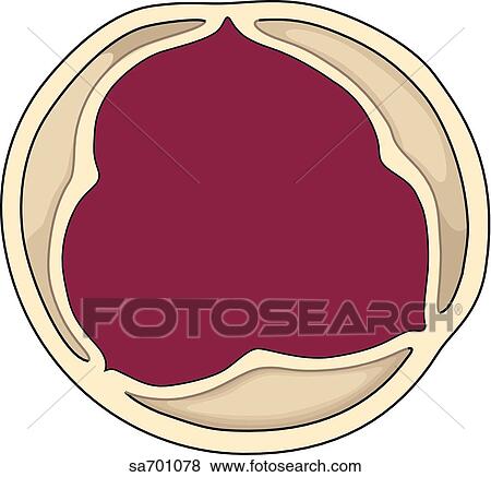Superior view of semilunar valve consisting of three crescent shaped cusps that prevent back flow of blood when opened. View Large Illustration Stock Illustration - Superior view of semilunar valve consisting of three crescent shaped cusps that prevent back flow of blood when opened.. Fotosearch