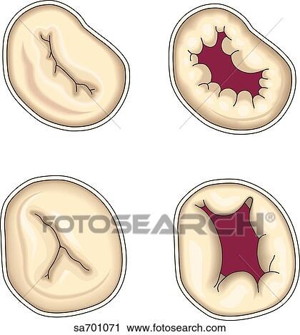 Clip Art - View from above of the atrioventricular valves; closed (left) and open (right).. Fotosearch