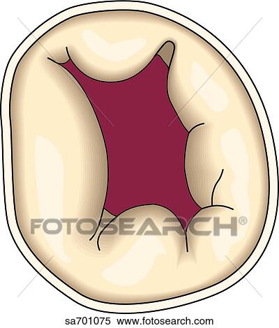 View from above of the opened tricuspid valve. View Large Illustration Stock Illustration - View from above of the opened tricuspid valve.. Fotosearch
