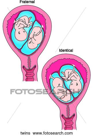 Types of Twins View Large Illustration Stock Illustration - Types of Twins. Fotosearch