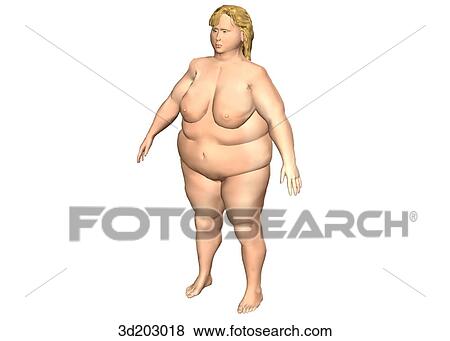 Stock Illustration - External view of obese woman; anterolateral view.. Fotosearch
