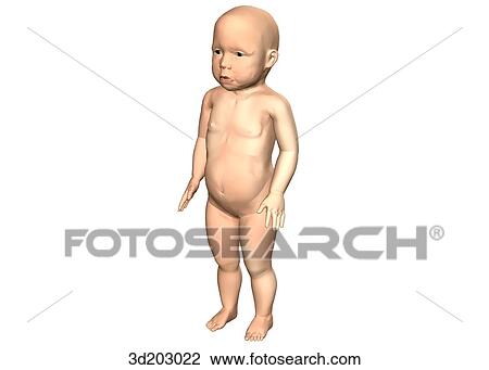 External view of toddler; anterolateral view. View Large Illustration Drawing - External view of toddler; anterolateral view.. Fotosearch