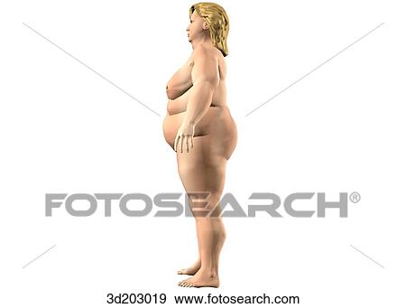 Stock Illustration - Lateral external view of obese woman.. Fotosearch