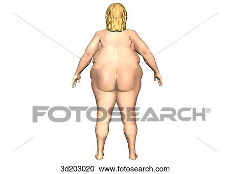 Clipart - Posterior external view of obese woman.. Fotosearch