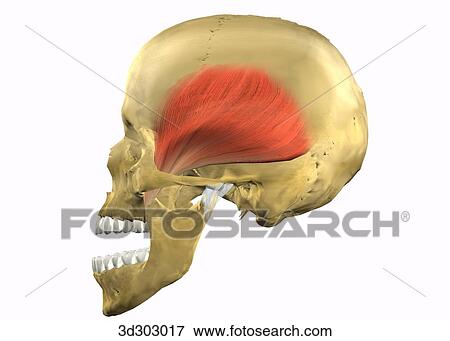 Stock Illustration - Lateral view of problematic temporomandibular joint (TMJ).. Fotosearch