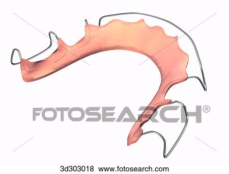 Stock Illustration - Oblique 3/4 view of type A retainer.. Fotosearch