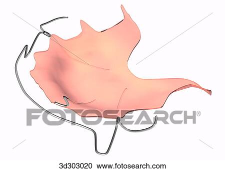 Clipart - Oblique 3/4 view of type B retainer.. Fotosearch