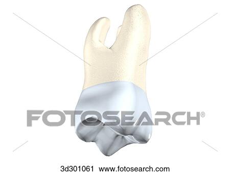 Clip Art - Oblique 3/4 view of upper right 1st molar.. Fotosearch