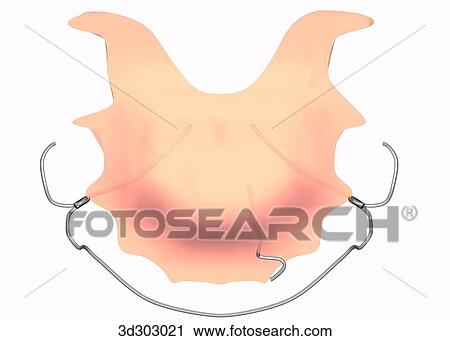 Superior view of type B retainer. View Large Illustration Clip Art - Superior view of type B retainer.. Fotosearch