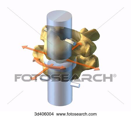 Anterior view of cervical vertebrae showing range of motion. View Large Illustration Stock Illustration - Anterior view of cervical vertebrae showing range of motion.. Fotosearch