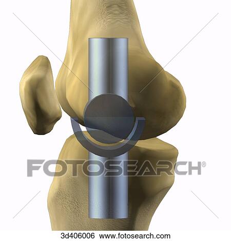Lateral view of extended knee joint superimposed onto symbolic representation. View Large Illustration Stock Illustration - Lateral view of extended knee joint superimposed onto symbolic representation.. Fotosearch
