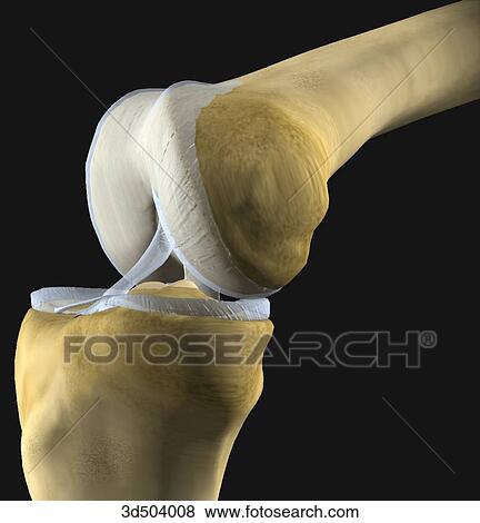 Stock Illustration - 3/4 view of flexed knee joint showing the condyles, menisci, and ligaments prior to knee arthroplasty.. Fotosearch