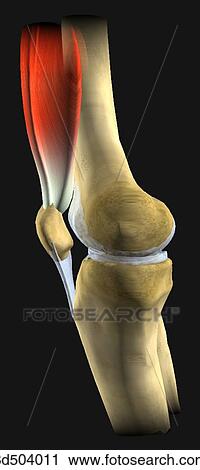 Lateral view of left knee prior to knee arthroplasty. View Large Illustration Clip Art - Lateral view of left knee prior to knee arthroplasty.. Fotosearch