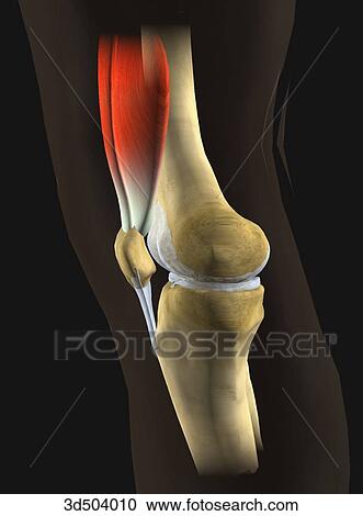 Clipart - Lateral view of the left knee showing anatomical structures through transparent legs; prior to knee arthroplasty.. Fotosearch