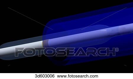 an unexpanded balloon catheter entering a cannula. View Large Illustration Stock Illustration - an unexpanded balloon catheter entering a cannula.. Fotosearch