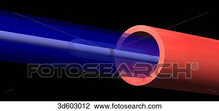 Schematic view showing an unexpanded balloon catheter in a cannula which in turn is in an artery. View Large Illustration Drawing - Schematic view showing an unexpanded balloon catheter in a cannula which in turn is in an artery.. Fotosearch