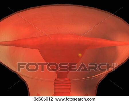 Stylized image showing a frontal view of a uterus with a blastocyst about to implant into endometrium of the uterus. View Large Illustration Drawing - Stylized image showing a frontal view of a uterus with a blastocyst about to implant into endometrium of the uterus.. Fotosearch