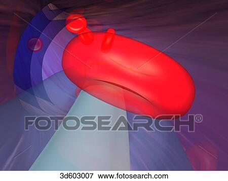 Stock Illustration - View from inside a cannula that has been passed through a coronary artery. A balloon catheter is being passed through the catheter. Erythrocytes can be seen.. Fotosearch
