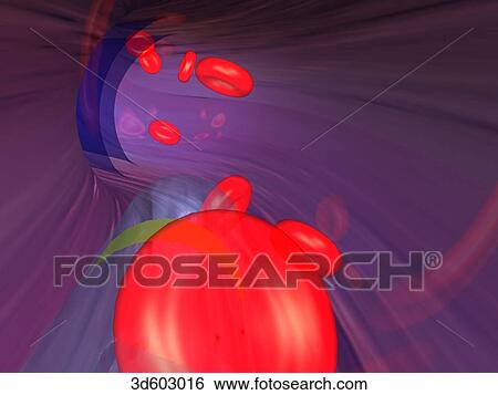Stock Illustration - View from within a cannula that has been passed through a coronary artery. Erythrocytes are passing through and the tip of a balloon catheter can be seen at bottom.. Fotosearch