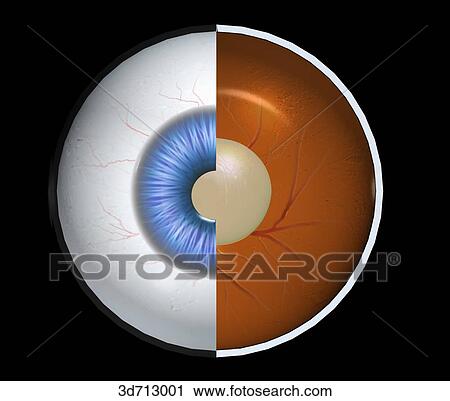 Clip Art - Cataract. Image showing the complete or partial opacity of the lens.. Fotosearch