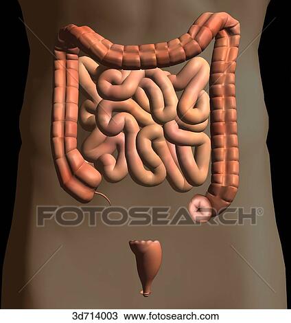 Drawing - Establishment of an artificial connection between the lumen of the colon and the skin. Fotosearch