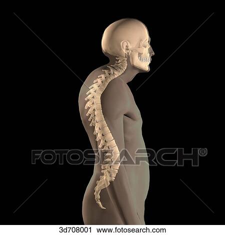 Kyphosis is the anteriorly concave curvature of the vertebral column. View Large Illustration Clip Art - Kyphosis is the anteriorly concave curvature of the vertebral column.. Fotosearch