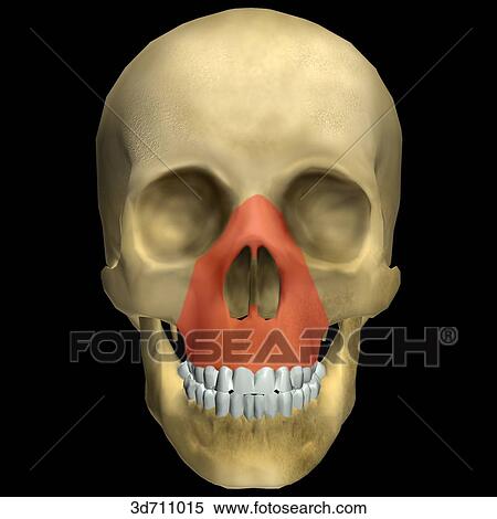 Le Fort II is the fracture of the midfacial skeleton with the principle fracture lines meeting at an apex at or near the superior aspect of the nasal bones. View Large Illustration Stock Illustration - Le Fort II is the fracture of the midfacial skeleton with the principle fracture lines meeting at an apex at or near the superior aspect of the nasal bones.. Fotosearch