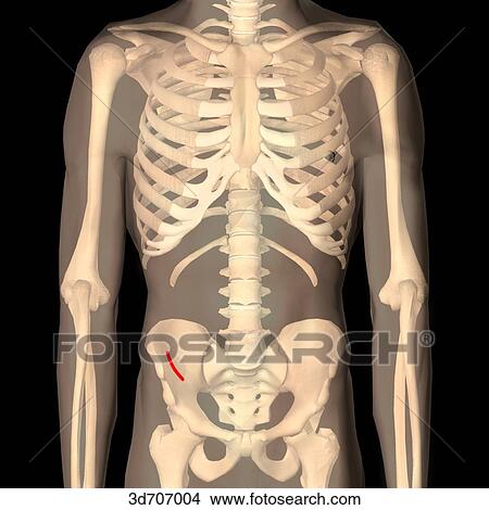 Stock Illustration - McBurney incision. An incision parallel with the course of the external oblique muscle, one or two inches cephalad to the anterior superior spine of the ilium.. Fotosearch