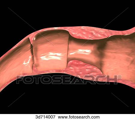 Normal view of sphincter. View Large Illustration Stock Illustration - Normal view of sphincter.. Fotosearch