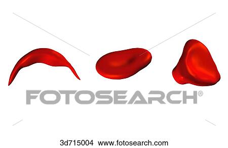 Red blood cells of irregular shape: drepanocyte (sickle cell) (left), elliptocyte (middle), knizocyte (right). View Large Illustration Stock Illustration - Red blood cells of irregular shape: drepanocyte (sickle cell) (left), elliptocyte (middle), knizocyte (right).. Fotosearch