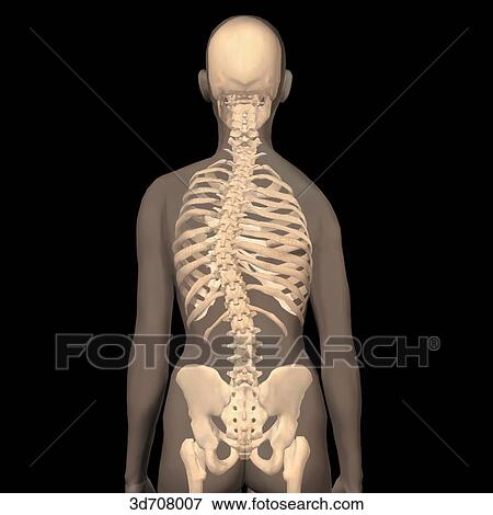 Scoliosis is the abnormal lateral and rotational curvature of the vertebral column. View Large Illustration Stock Illustration - Scoliosis is the abnormal lateral and rotational curvature of the vertebral column. . Fotosearch
