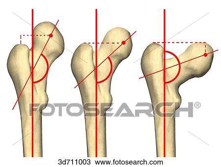 Drawing - Varying configurations of the angle of the hip joint.. Fotosearch
