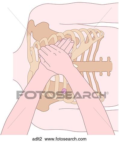 CPR Positioning Adult 2 View Large Illustration Drawing - CPR Positioning Adult 2. Fotosearch