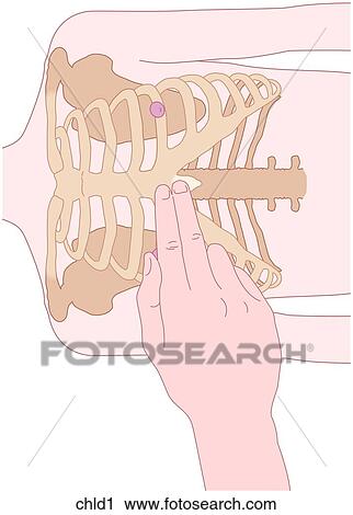 Clip Art - CPR Positioning Child 1. Fotosearch