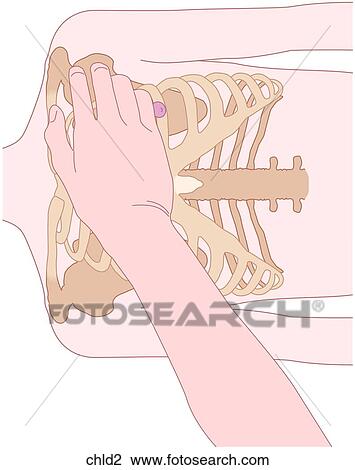 Drawing - CPR Positioning Child 2. Fotosearch