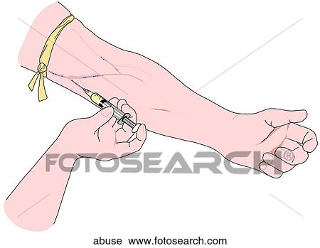 Drug Abuse-Injection View Large Illustration Clip Art - Drug Abuse-Injection. Fotosearch