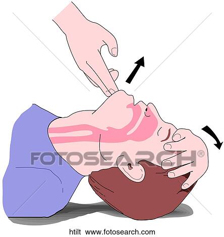 Head Tilt View Large Illustration Stock Illustration - Head Tilt. Fotosearch
