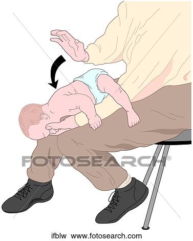 Stock Illustration - Infant Back Blows. Fotosearch