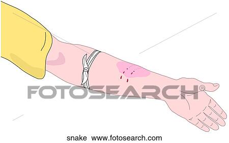 Snake Bite View Large Illustration Clip Art - Snake Bite. Fotosearch