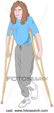 Stock Illustration - Using Crutches-Cast. Fotosearch