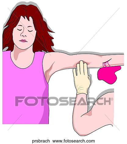 Brachial Pressure Point View Large Illustration Drawing - Brachial Pressure Point. Fotosearch