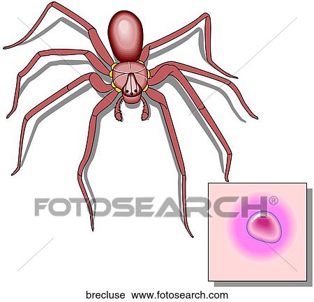Brown Recluse Spider View Large Illustration Clip Art - Brown Recluse Spider. Fotosearch
