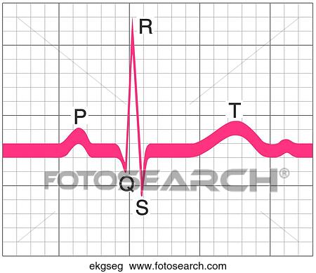 EKG Segment View Large Illustration Drawing - EKG Segment. Fotosearch